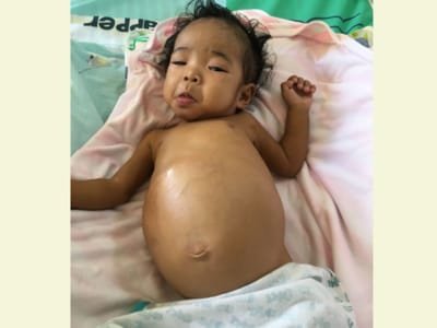 Help me save my dying daughter. She needs a liver transplant urgently